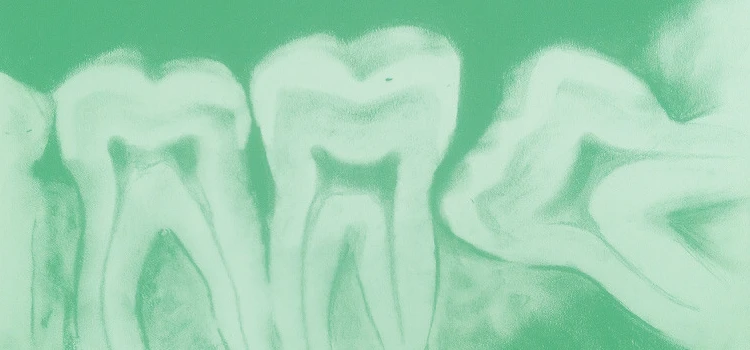 THE CAVITY COLLECTIVE 🦷's banner